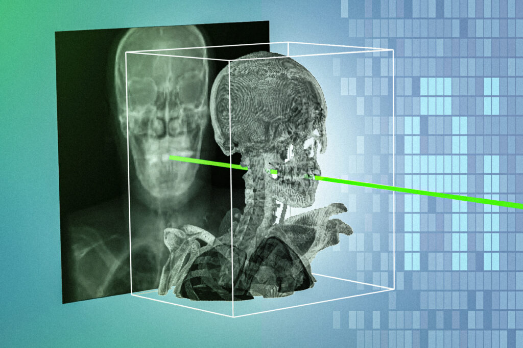 New AI technique could make minimally invasive surgeries safer and more precise | MIT News New AI technique could make minimally invasive surgeries safer and more precise | MIT News